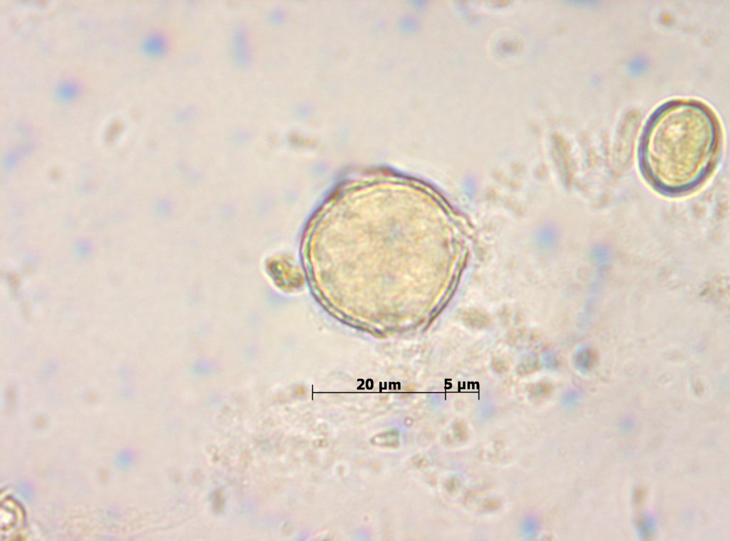F. Anacardiaceae: Pistacea