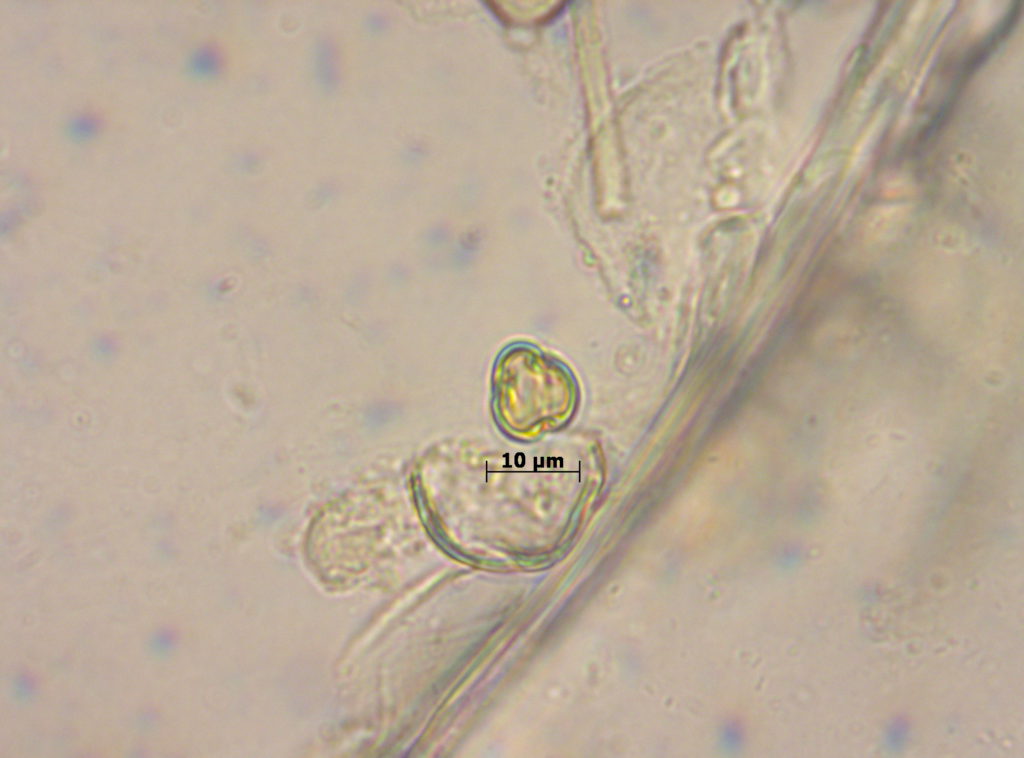 Fagaceae: Castanea (casi vista polar)