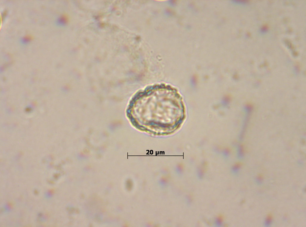 Ulmaceae: Ulmus