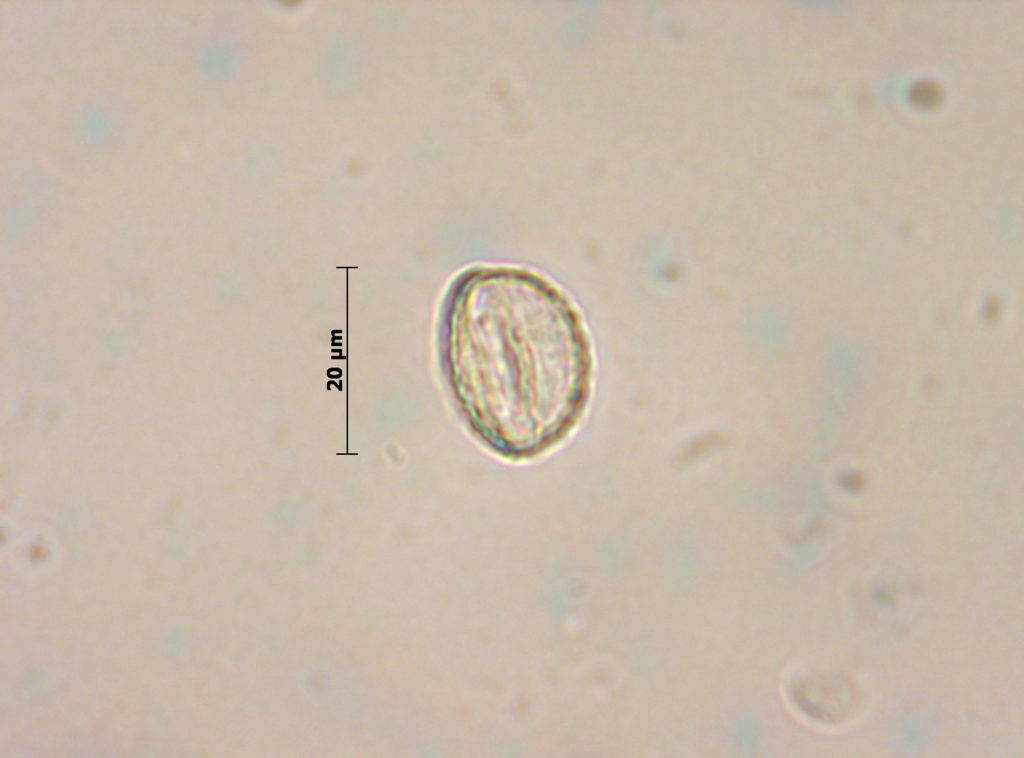 Ulmaceae: Ulmus