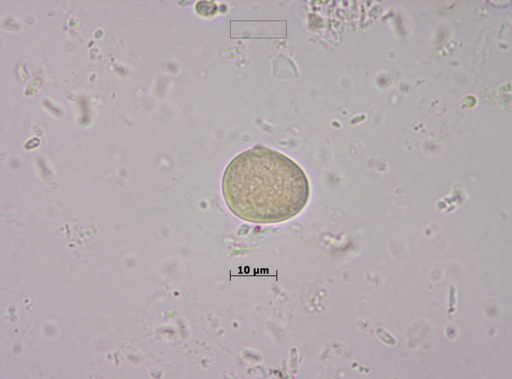 Grano de polen de Echium vulgare L.