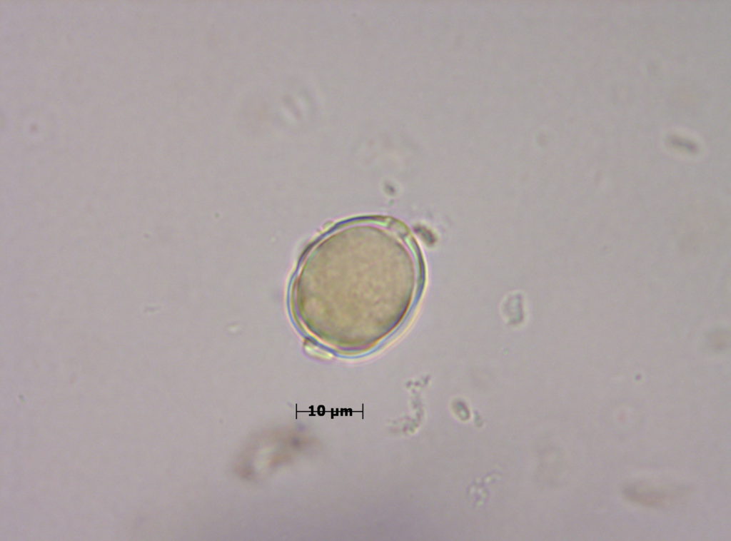 Myrtaceae: Eucaliptus (c.o.m.)