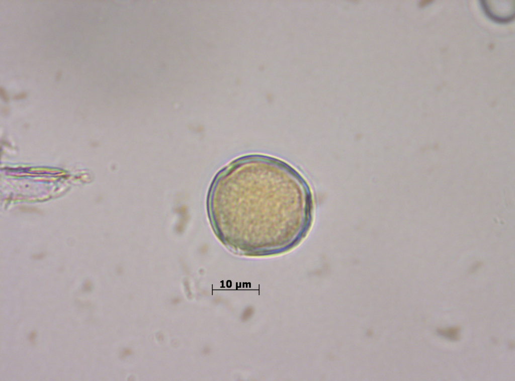 Fabaceae: Lotus (Vista polar)