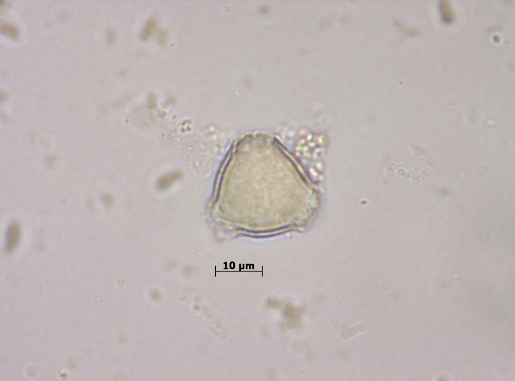 Rosaceae: Rubus