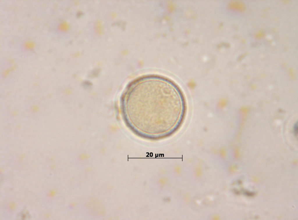 Grano de polen de Campanula