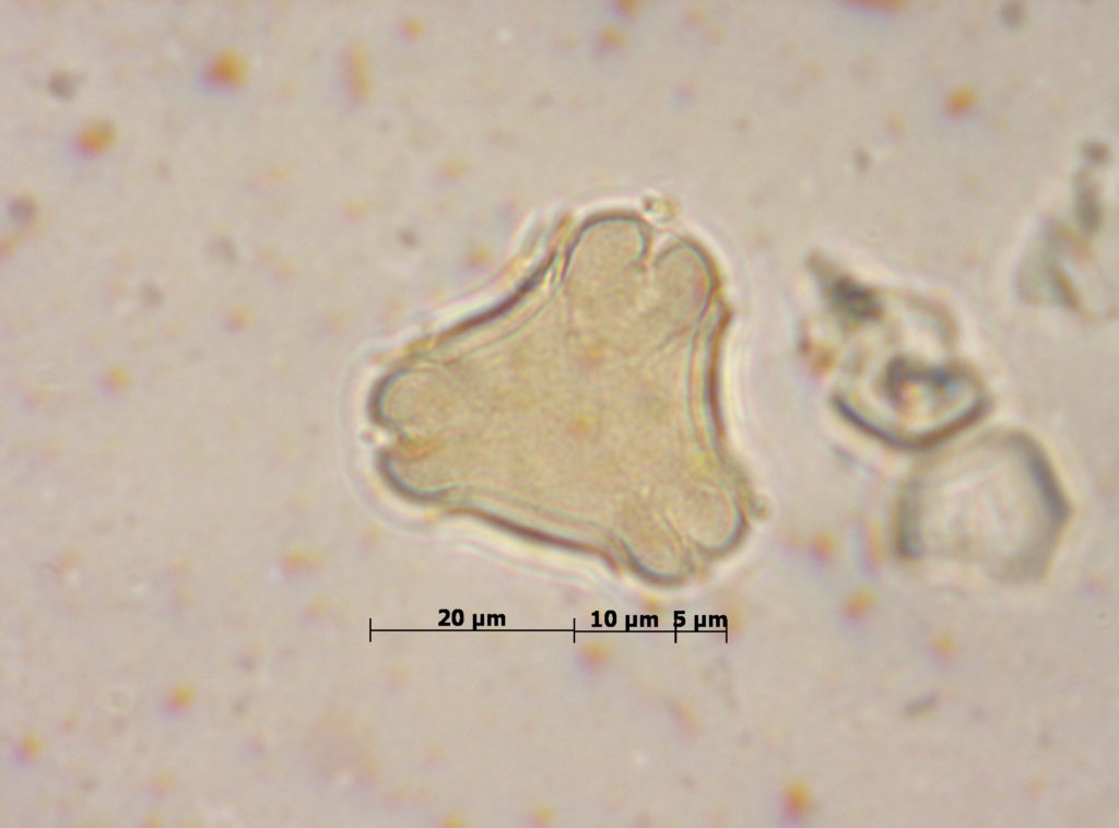 Rosaceae: Prunus