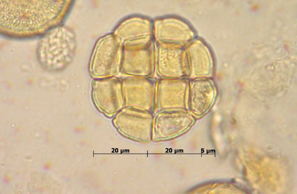Fabaceae: Acacia dealbata
